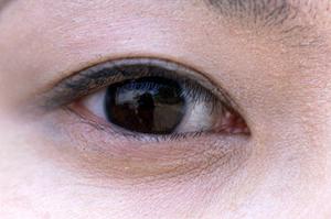 三宮駅近くでホワイトニングができます